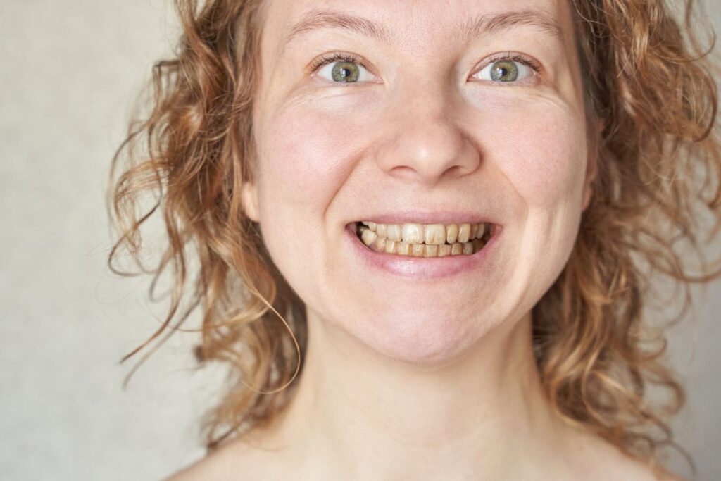 Graphic explaining why teeth may look yellow despite daily brushing